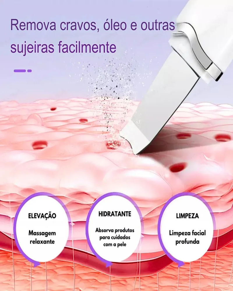 Espátula Ultrassônica de Limpeza Facial – Peeling, Removedor de Cravos e Massageador Facial